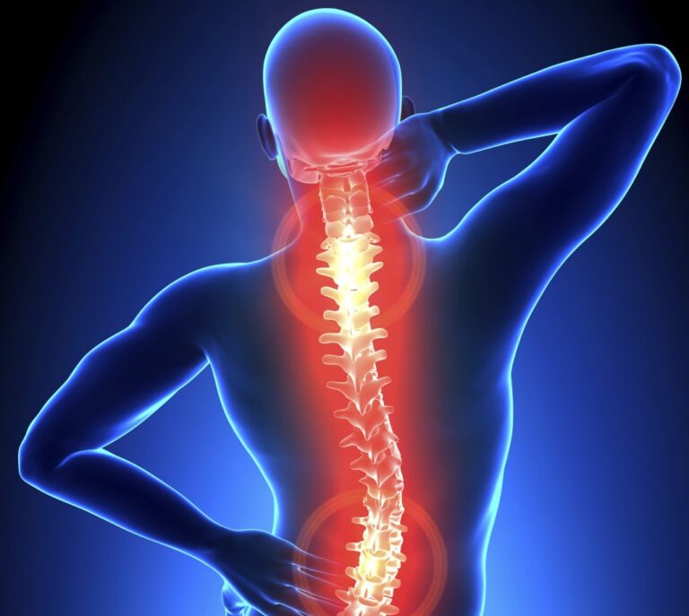 osteo-arthritis-neck-and-back-pain-northern-kentucky-cincinnati